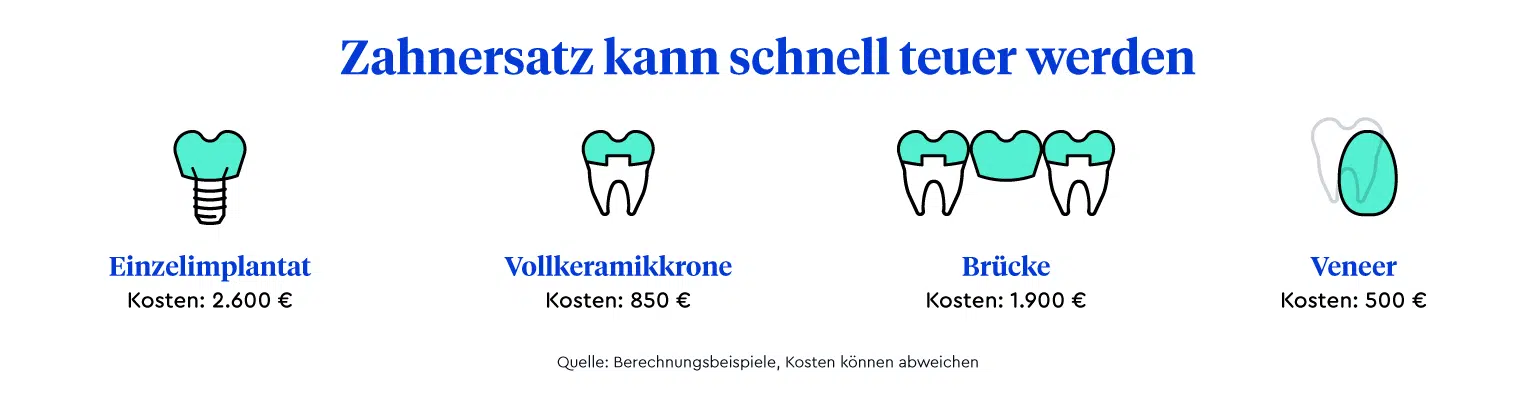 Eine Infografik, die die durchschnittlichen Kosten für Zahnersatz zeigt. Ein Einzelimplantat kostet durchschnittlich etwa 2.600 Euro, eine Vollkeramikkrone 850 Euro, eine Brücke 1.900 Euro und ein Veneer 500 Euro.